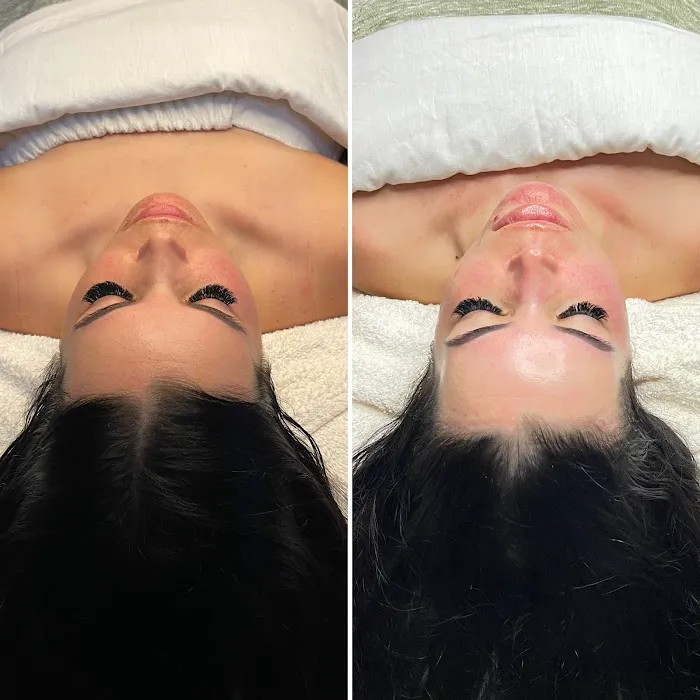 The Aesthetics Bar Picture 9