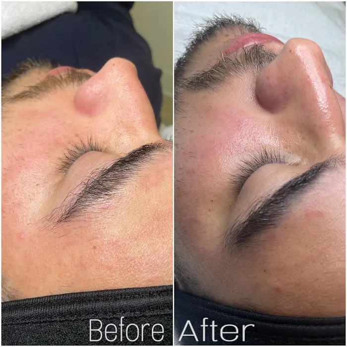 Skin & Soul Picture 4