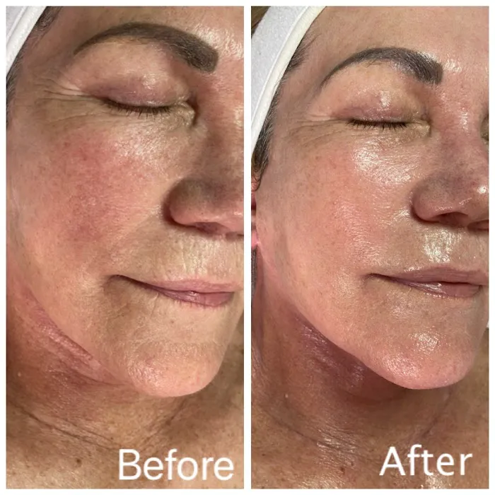 Skinthetics Glow Spa Picture 6