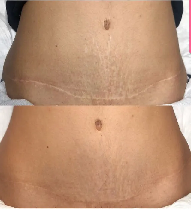 Skin Kamo by Kery Picture 2