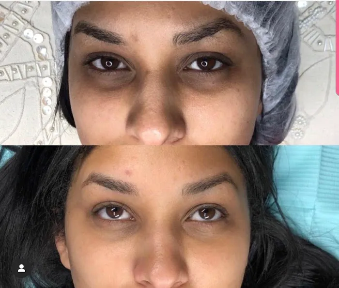 Skin Kamo by Kery Picture 4