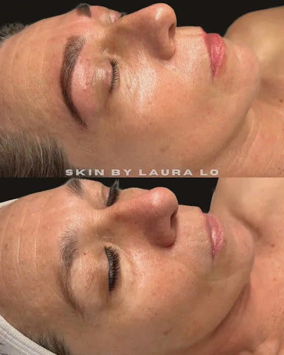 Skin by Laura Lo Picture 1