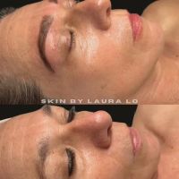 Skin by Laura Lo ico