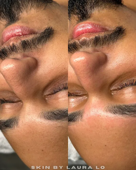 Skin by Laura Lo Picture 7