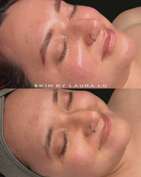 Skin by Laura Lo Picture 5