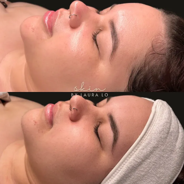 Skin by Laura Lo Picture 4