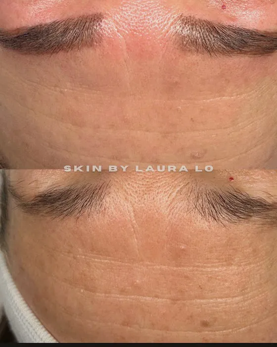 Skin by Laura Lo Picture 8