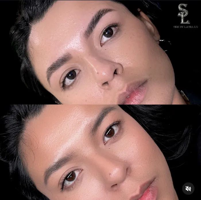 Skin by Laura Lo Picture 10