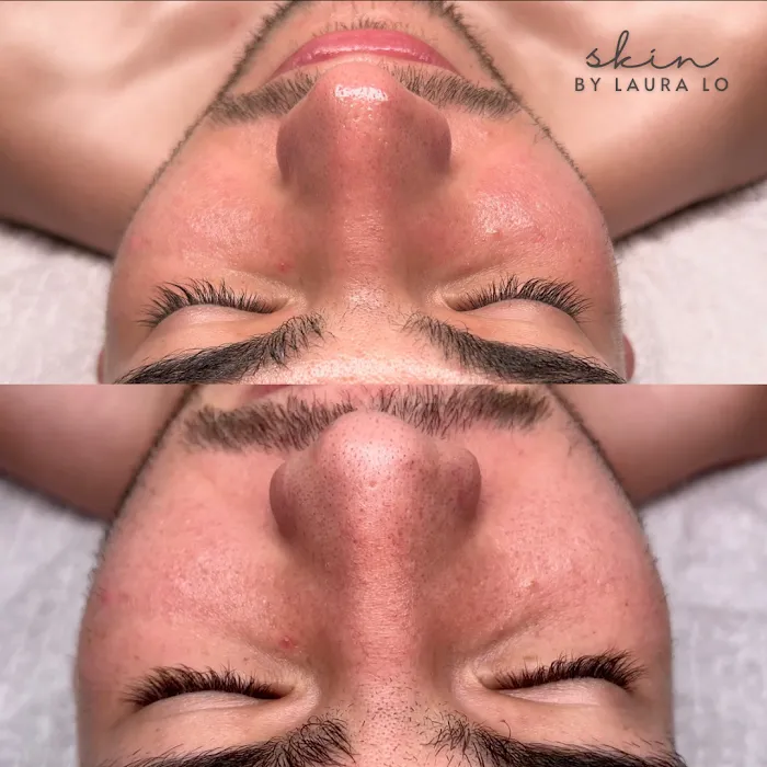 Skin by Laura Lo Picture 9