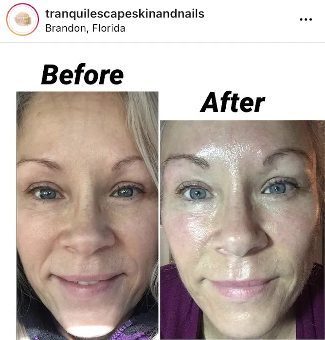 Tranquil Escape Skin Therapy LLC Picture 8