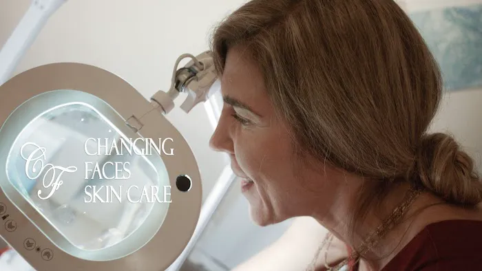 Changing Faces Skin Care Picture 2