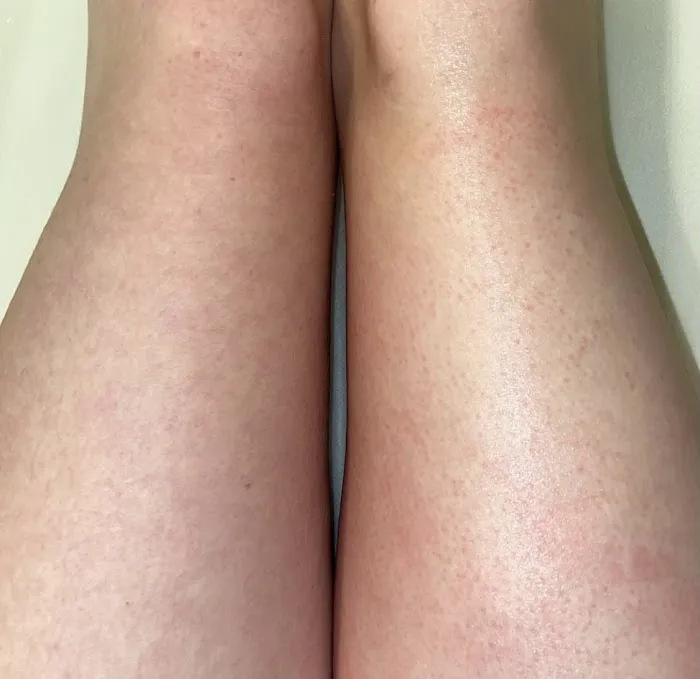 Tampa SKN Studio Picture 9