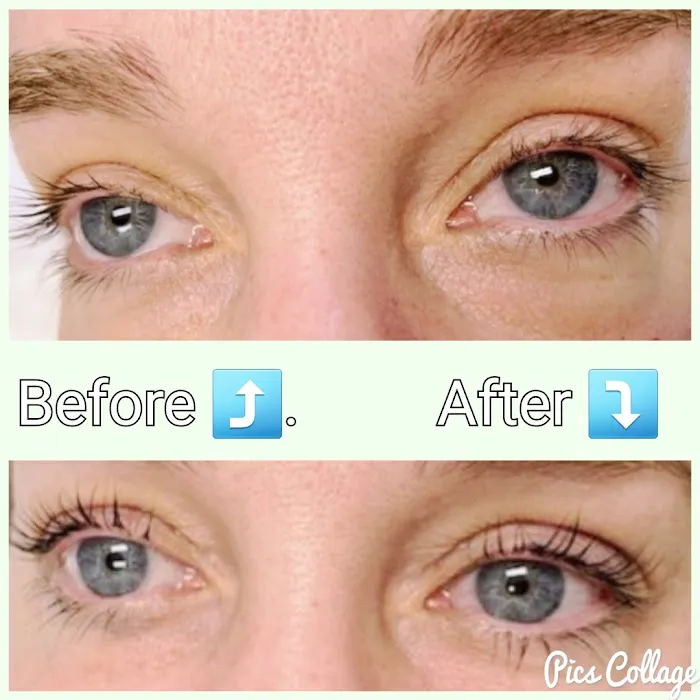 Skin Refined Esthetics Picture 2