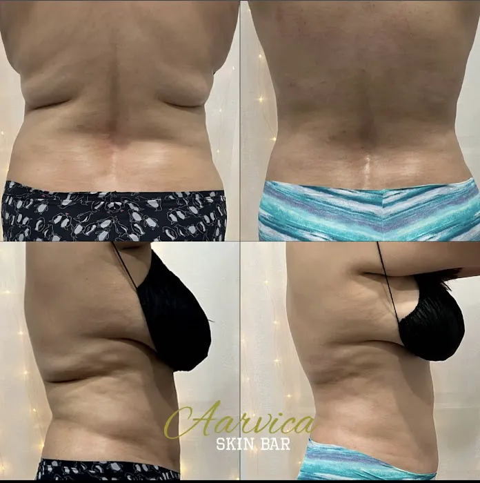 Aarvica Skin Bar Picture 3