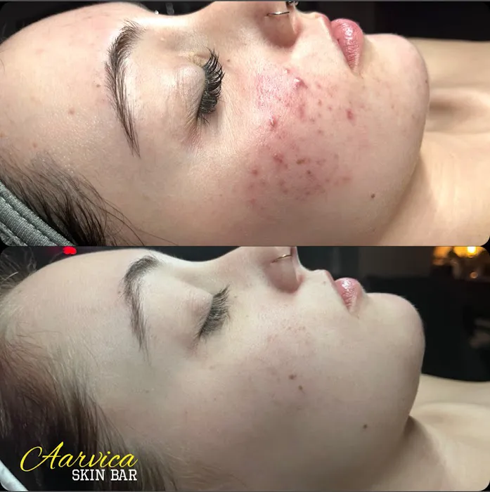 Aarvica Skin Bar Picture 4