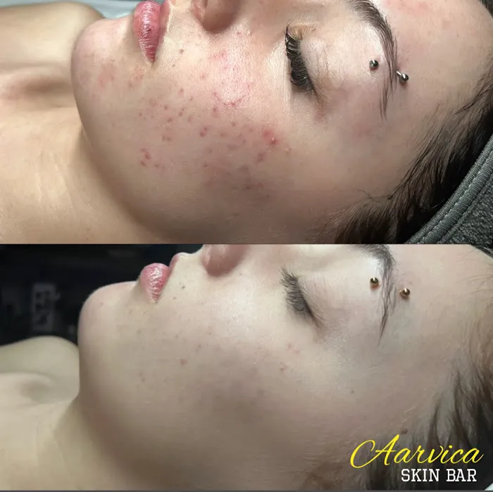 Aarvica Skin Bar Picture 7