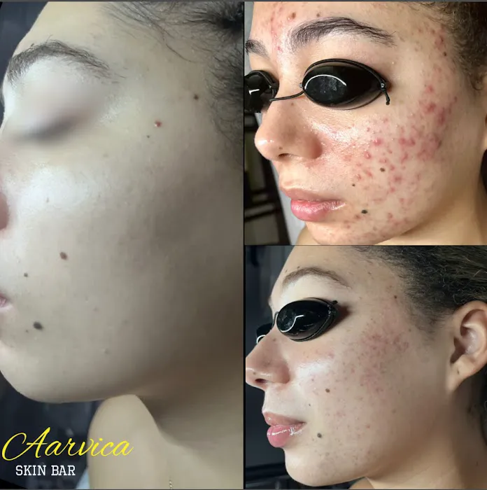 Aarvica Skin Bar Picture 6