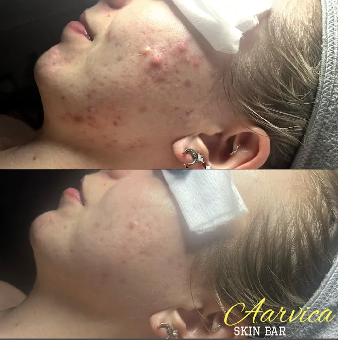 Aarvica Skin Bar Picture 8