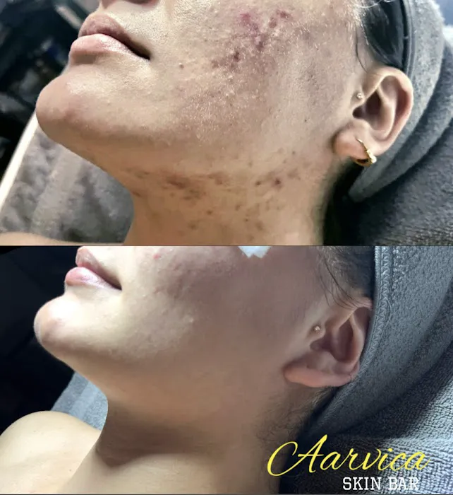 Aarvica Skin Bar Picture 5