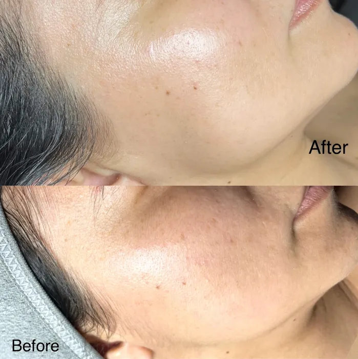 Aarvica Skin Bar Picture 9