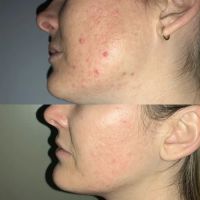 Linda Rae Skin Care ico