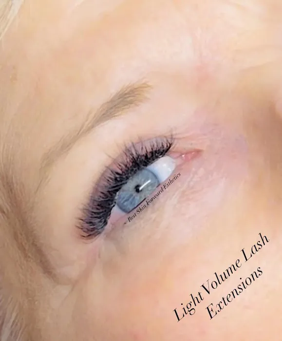 Best Skin Forward Esthetics LLC Picture 5