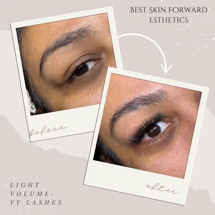 Best Skin Forward Esthetics LLC Picture 10