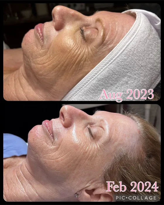 Best Skin Forward Esthetics LLC Picture 9