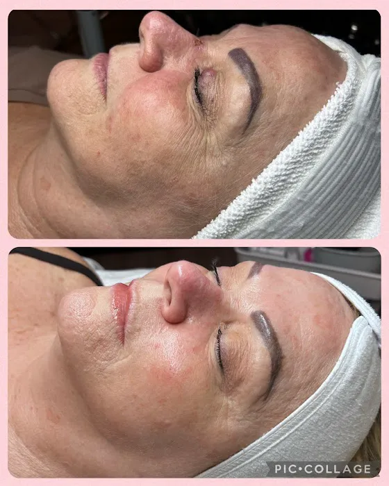 Best Skin Forward Esthetics LLC Picture 7