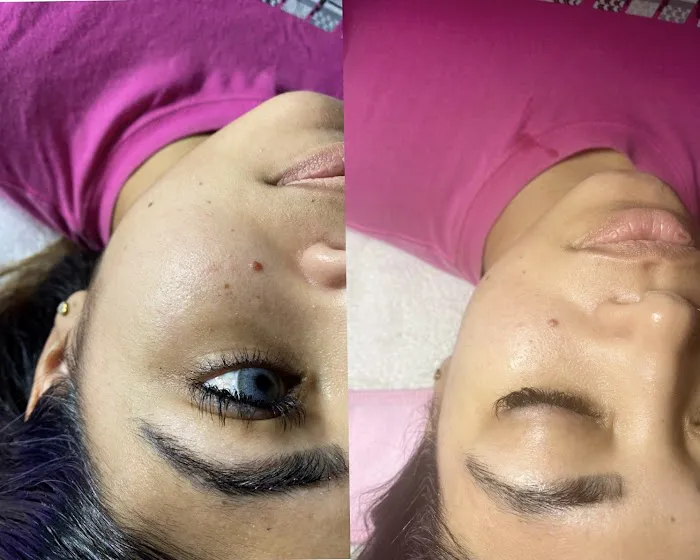 Pura Piel Skin Care Picture 2