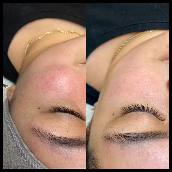 Pura Piel Skin Care Picture 5