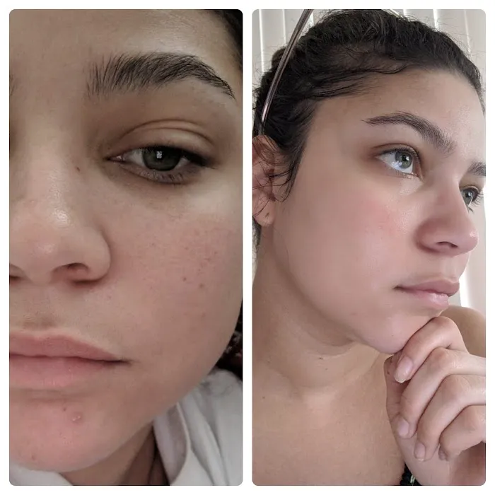 Pura Piel Skin Care Picture 4