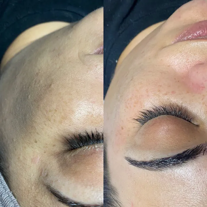 Pura Piel Skin Care Picture 6