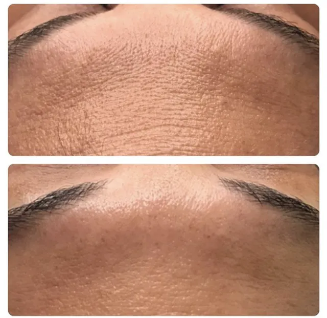 Valerie LoCicero - Licensed Esthetician Picture 8