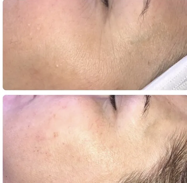 Valerie LoCicero - Licensed Esthetician Picture 9