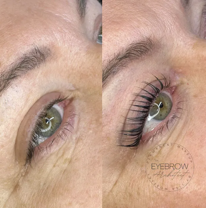 La Bella Vita Aesthetics Picture 10