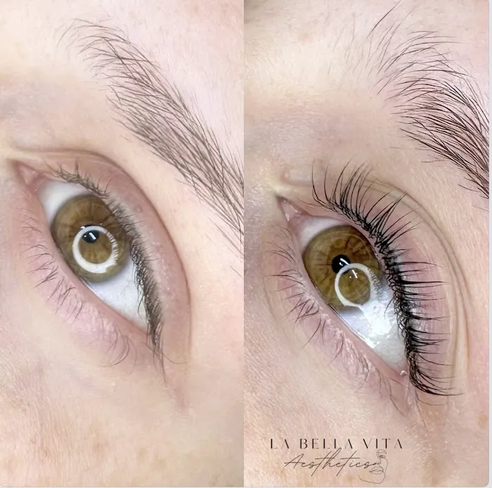 La Bella Vita Aesthetics Picture 8