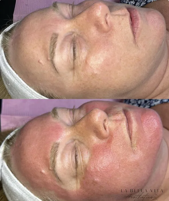 La Bella Vita Aesthetics Picture 7