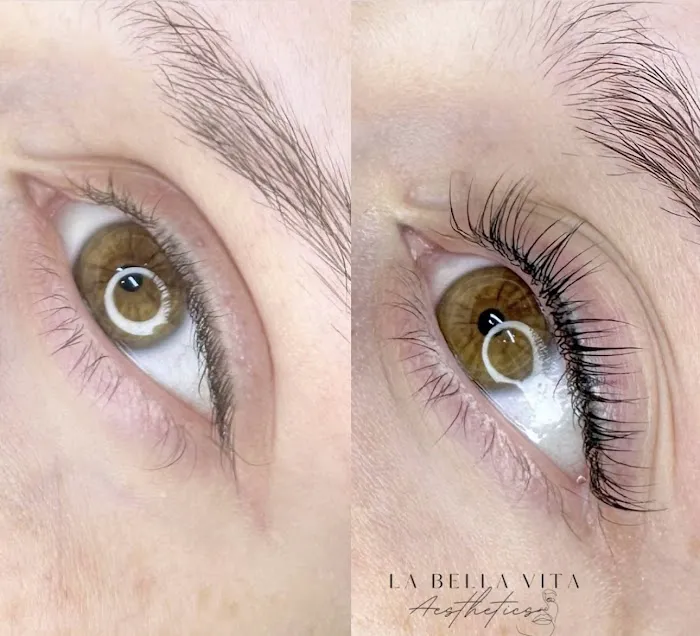 La Bella Vita Aesthetics Picture 9