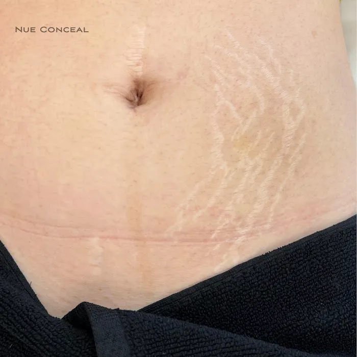 Piel Bella Clinica Estetica Picture 4