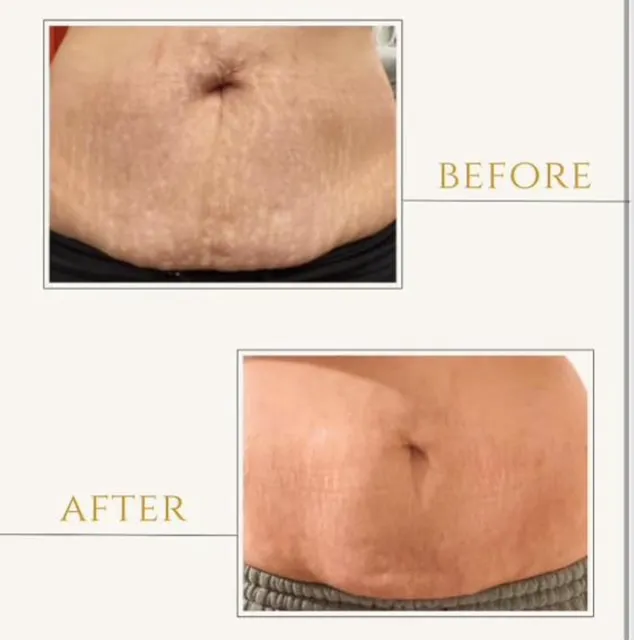 Piel Bella Clinica Estetica Picture 8