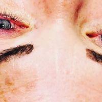 SkinO2 Esthetics ico