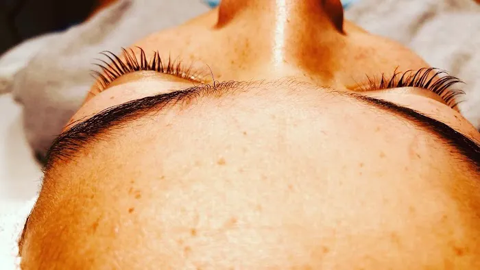 SkinO2 Esthetics Picture 2