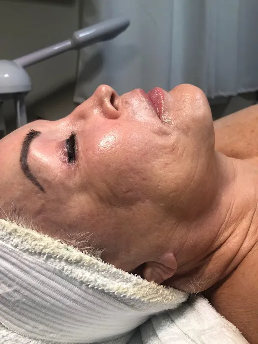 SkinO2 Esthetics Picture 3