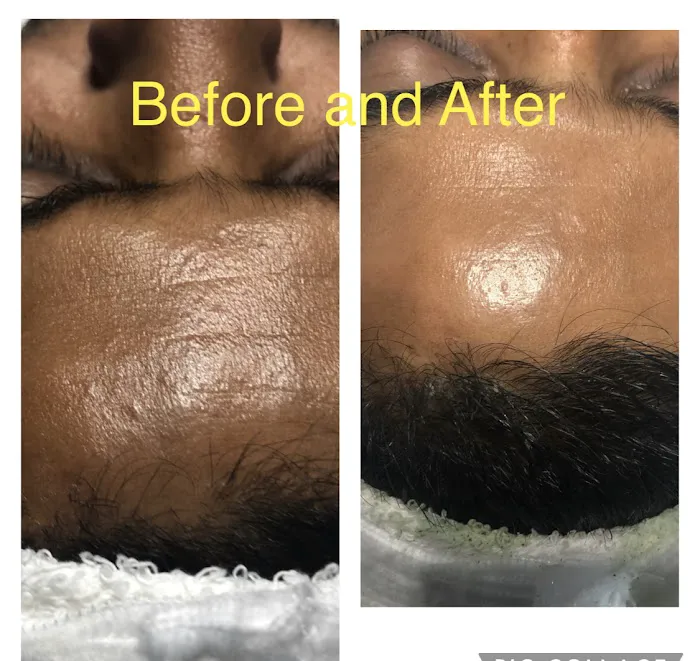 SkinO2 Esthetics Picture 8