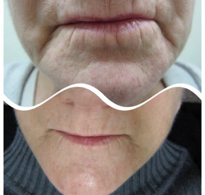 360 Aesthetics Picture 8