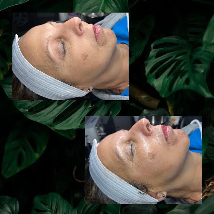 SYNSKN Esthetics Picture 6