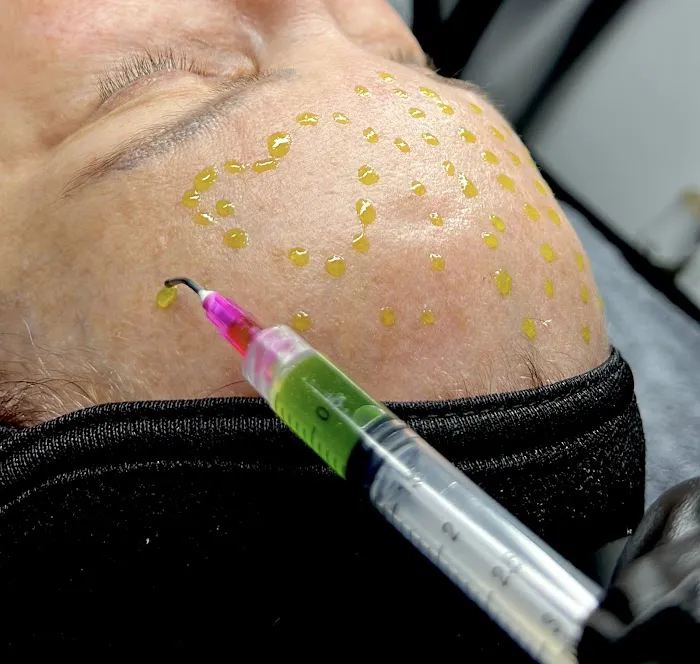 SYNSKN Esthetics Picture 7