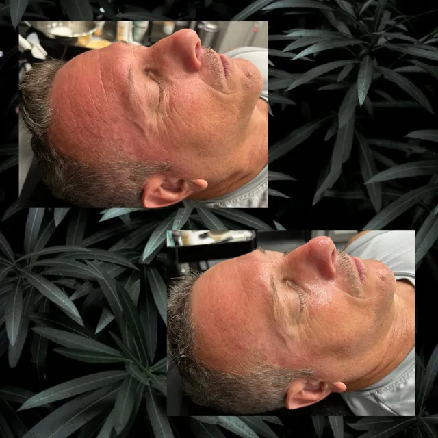 SYNSKN Esthetics Picture 10