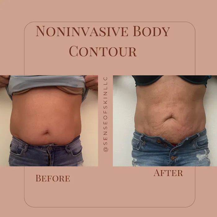 Sense of Skin Picture 10